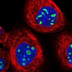 EBNA1BP2 Antibody, Novus Biologicals:Antibodies:Primary Antibodies